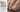 How to Get Rid of Toenail Fungus Permanently — The Complete Guide - Dermachom.com