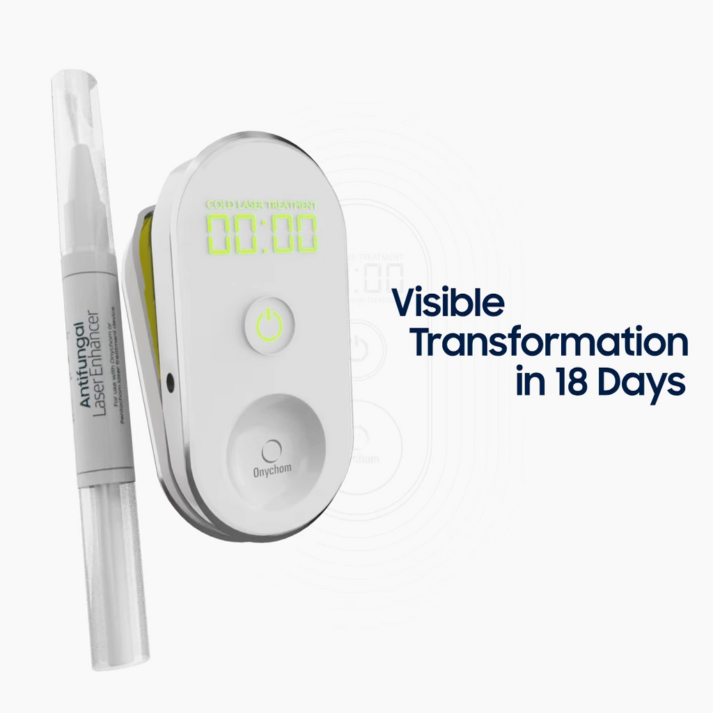 Onychom - Antifungal Laser Device