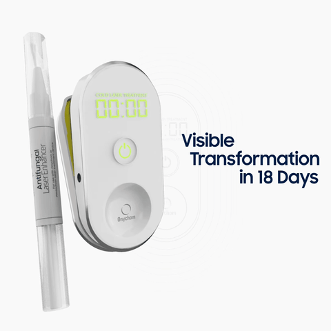 Onychom - Antifungal Laser Device - Dermachom.com