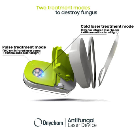 Onychom - Antifungal Laser Device - Dermachom.com